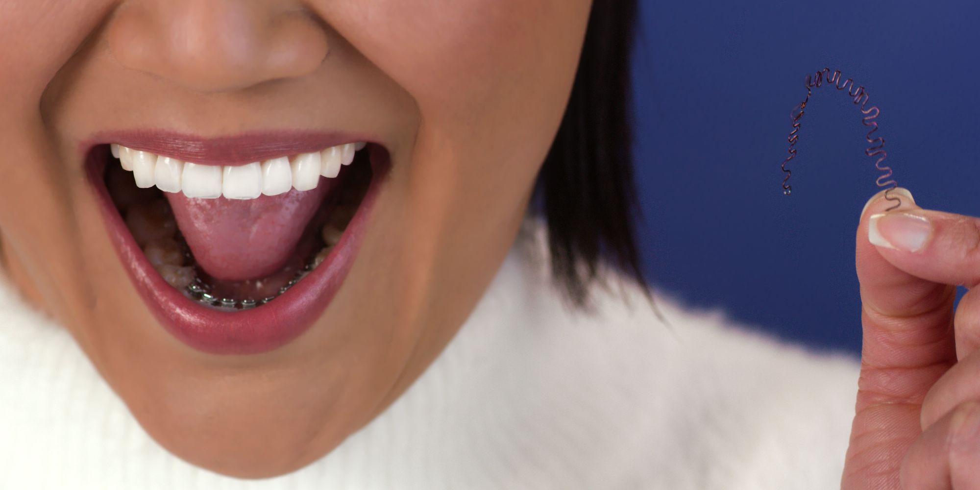 INBRACE Lingual Braces, District Orthodontics